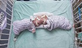 Gêmeas Erin e Abby Delaney no Hospital Infantil da Filadélfia, em setembro de 2016 I Foto: AP